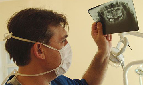 Рентген Шулера при проблемах с зубами
